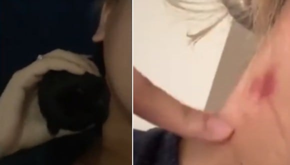 Una joven se puso a jugar con su perrita y esta acabó haciéndole un chupetón en el cuello. (Foto: Caters Clips / YouTube)