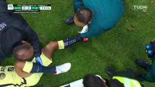Alarma en la Liga MX: Santiago Naveda se rompió el tobillo durante el América vs. Puebla [VIDEO]